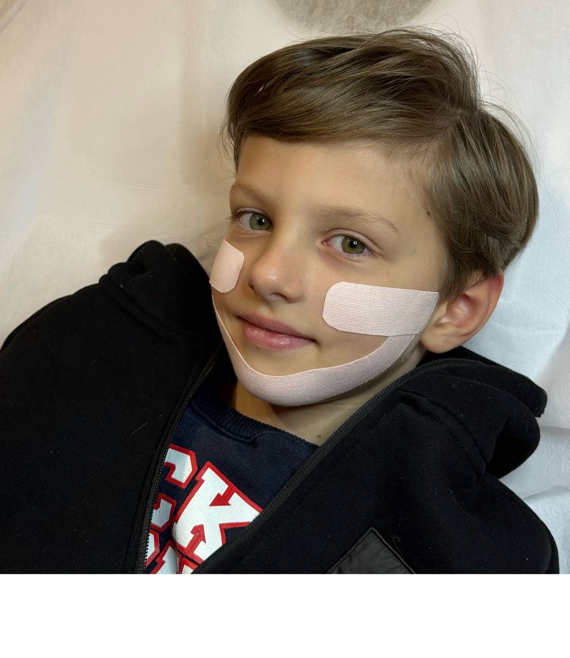 Техніка кінезіотейпування